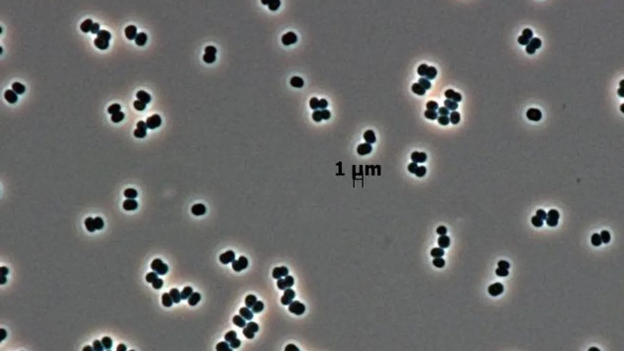 olu taklidi yapan super bakteriler uzayi bile tehdit ediyor hLxi4Gui.jpg