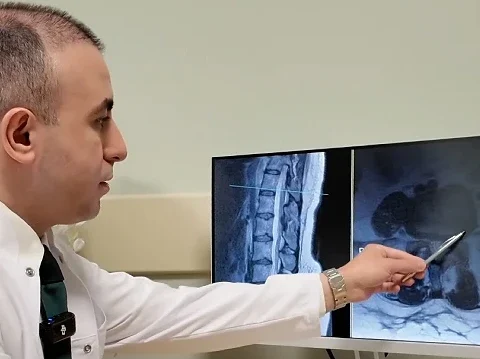 Bel Fıtığı Hakkında Bilmeniz Gerekenler ve Ameliyatın Sonuncu Çare Olduğu Uyarısı